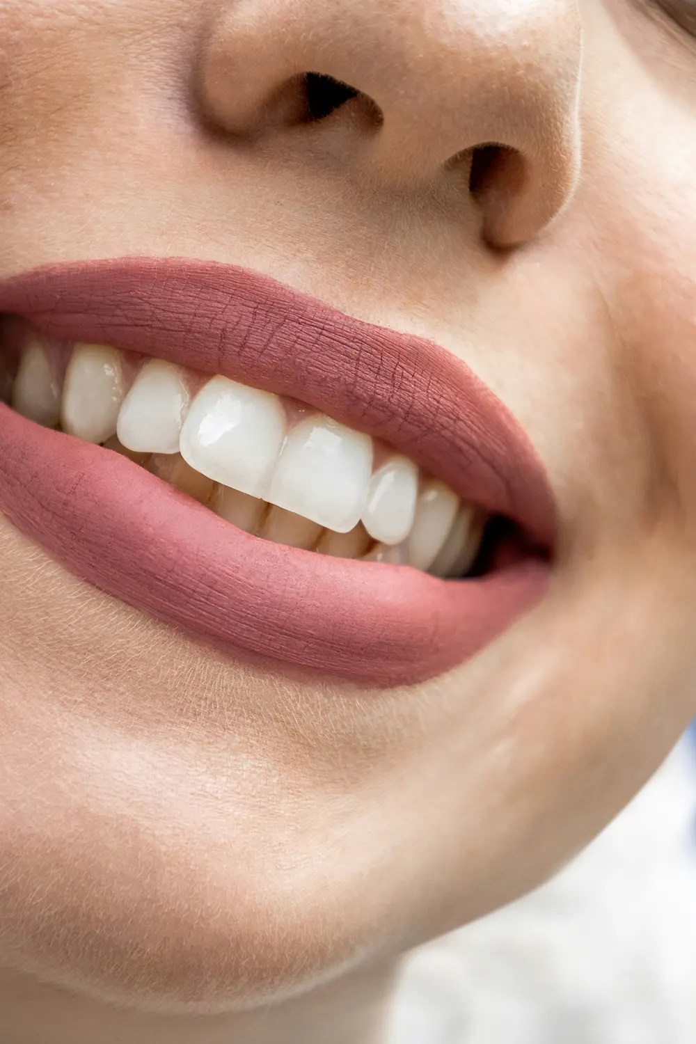 Best Dermal Fillers in Dubai Best Dermal Fillers in Dubai