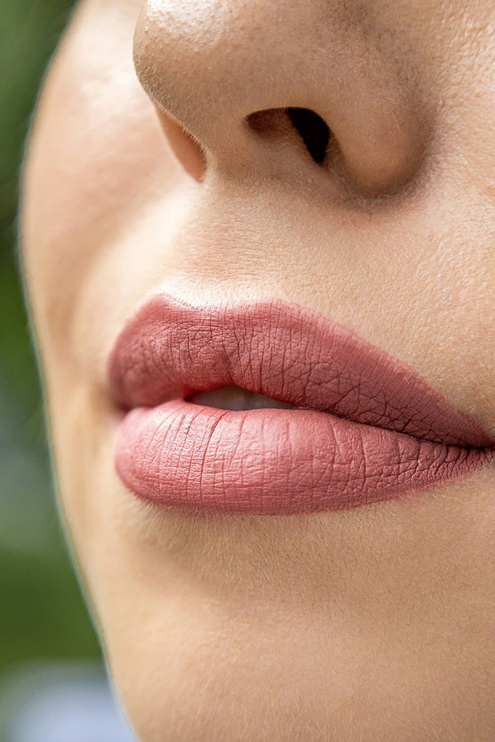 Lip Fillers Lip Fillers in Dubai